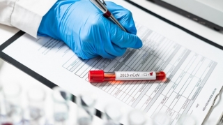 Azərbaycanda daha 24 nəfər koronavirusa yoluxdu