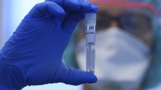 Azərbaycanda daha 21 nəfər COVID-19-a yoluxub, 1 nəfər vəfat edib 