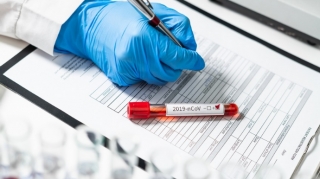 Azərbaycanda son sutkada 96 nəfər koronavirusa yoluxub, 2 nəfər ölüb 