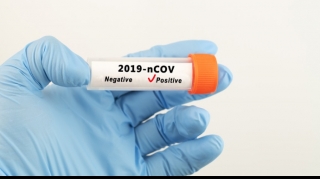 Azərbaycanda 1 227 yeni yoluxma  faktı qeydə alındı