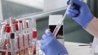 Hikmət Hacıyevdən koronavirus vaksinləri ilə bağlı VACİB AÇIQLAMA 