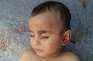 Zəhranın öldürülməsi ilə bağlı yürüş keçiriləcək