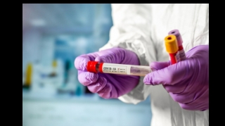 Azərbaycanda daha 17 nəfər koronavirusdan vəfat edib - FOTO 