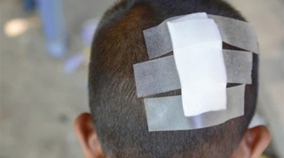 Hesaba görə kafe sahibi ilə mübahisədə - 6 yaşlı oğlu başından zərbə aldı 