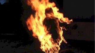 Мужчина, получивший ожоги в Баку, скончался спустя восемь дней 