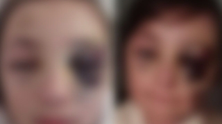 Məktəbdən döyüldüyü deyilən şagirdlə bağlı açıqlama   - FOTO - YENİLƏNİB