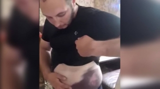 İşgəncə verilən Vüqar:  "QAZel"dəki palçığı bizə yedizdirmək istəyirdilər - FOTO - VİDEO 