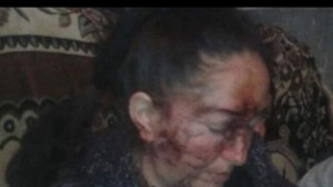 Dəhşətli görüntülər: Azərbaycanda kişi arvadı yatdığı yerdə başına butulka vurdu - FOTO