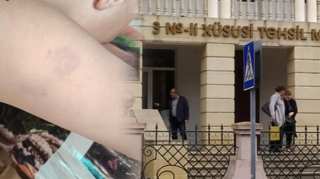 Xüsusi məktəbdə müəllim azyaşlıya şiddət göstərib? - RƏSMİ   - FOTO