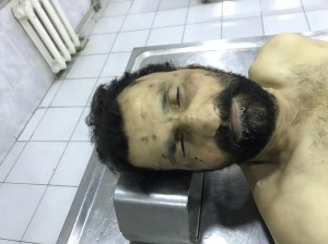 Bakıda küçədən kişi meyiti aşkarlandı - FOTO