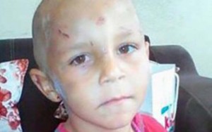 Valideynləri 4 yaşlı uşağı döyüb küçəyə atıblar?  - FOTO  