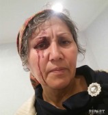 Masallıda 4 nəfər evə hücum edərək ər və arvadı bıçaqlayıb - FOTO