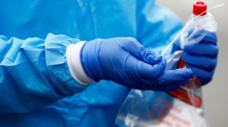 Bu gün neçə nəfər COVID-19-a yoluxub? - RƏSMİ 