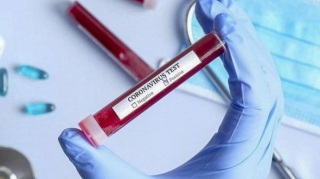 İranda son sutkada koronavirusdan 70 nəfər ölüb