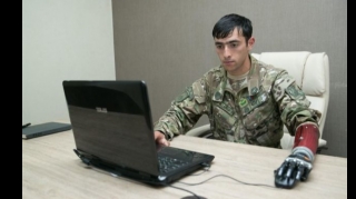 Protezlə təmin olunan Vətən müharibəsi qazilərinin sayı AÇIQLANDI  