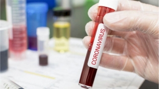 Azərbaycanda indiyədək neçə koronavirus testi aparılıb?