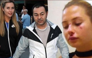 Kloe motosikletdən yıxıldı - Vəziyyəti ağırdır