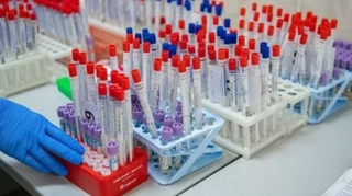 54 jurnalist koronavirusa yoluxub, 3 nəfəri ölüb 