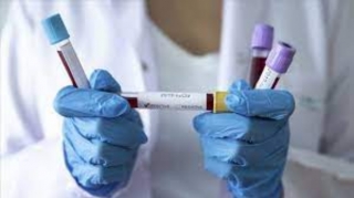 Son gündə koronavirusa 110 yoluxma qeydə alınıb, 4 nəfər ölüb
