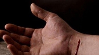 Türkiyədə “Renault” elektrik dirəyinə çırpıldı:  3 nəfər yanaraq öldü - FOTO 