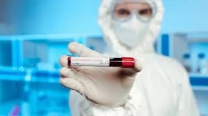 Virusdan xilas yolu tapılır                               – Azərbaycanlı həkim YENİ ELMİ NƏTİCƏni şərh edir