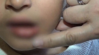 Azərbaycanda diş həkimi azyaşlını döyüb? - VİDEO 