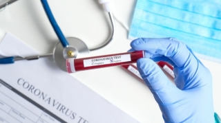 Ermənistanda koronavirusa yoluxanların sayı 35 mini ötdü