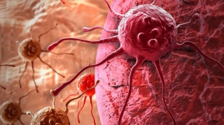 Xərçənglə mübarizə üsulu tapıldı