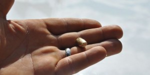 İki gün sərxoş olduğunu düşündülər: başından mərmi çıxdı