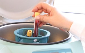 Azərbaycanda daha 25 nəfərdə koronavirus aşkarlandı                       - 1 nəfər öldü, 122-si sağaldı