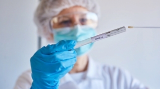 Azərbaycanda daha 79 nəfər koronavirusa yoluxdu  - FOTO