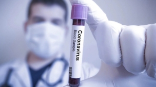 Azərbaycanda 53 nəfər koronavirusa yoluxdu, 6 nəfər öldü 