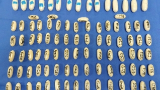 Bağırsağında 100-dən çox heroin kapsulunu keçirməyə çalışan şəxs İspaniyada hava limanında saxlanıldı - FOTO 
