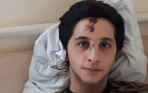 “Sürücü bir anlıq maqnitofona baxıb…” - Yaralı Əfsər danışır