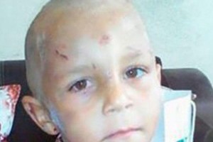 Bakıda döyülüb küçəyə atılan 4 yaşlı uşaqla bağlı DƏHŞƏTLİ FAKTLAR - VİDEO