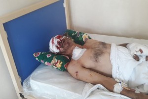 “KamAZ”ın təkəri partladı: ustanın gözü çıxdı - FOTO