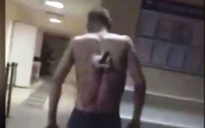 Yaralı kürəyində bıçaqla siqaret çəkməyə çıxdı – VİDEO