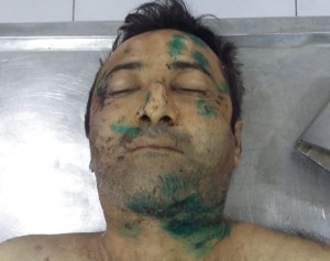 Bu şəxsi tanıyanlar 102-yə xəbər versin - FOTO