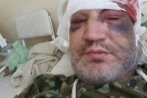 Vəhşilik: Azərbaycanlı sürücünün maşınını yandırıb, özünü ölümcül döydülər - FOTO+VİDEO