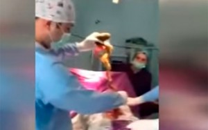 Qadının mədəsindən elə şeylər çıxdı ki... - Bakıda şok - VİDEO