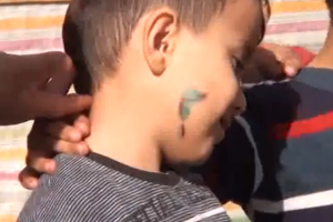 Çaqqal 4 yaşlı uşağı dişləyib - VİDEO