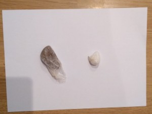 Daxili orqanında narkotik vasitə və psixotrop maddə aşkarlandı