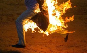 Qadın telefon şifrəsinə görə ərini yandırdı - FOTO