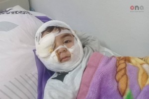 Paytaxtda it azyaşlının üzünü parçalayıb