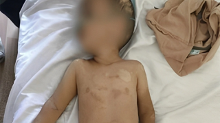 Həmin 3 yaşlı uşağın anasının valideynlik hüququ məhdudlaşdırıla bilər - FOTO - YENİLƏNİB